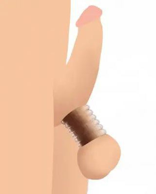 Pungstretcherset Med Flera Ringar